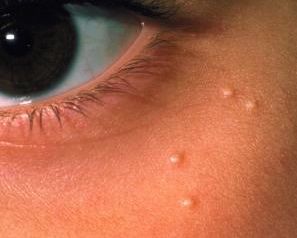 Slikovni rezultat za milije